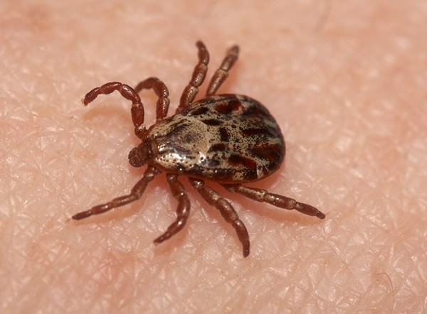 Close-up image of a tick on human skin.